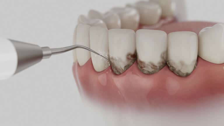 Trusted Teeth Cleaning And Checkup service in Lansdowne, PA - Dentist Open Now
